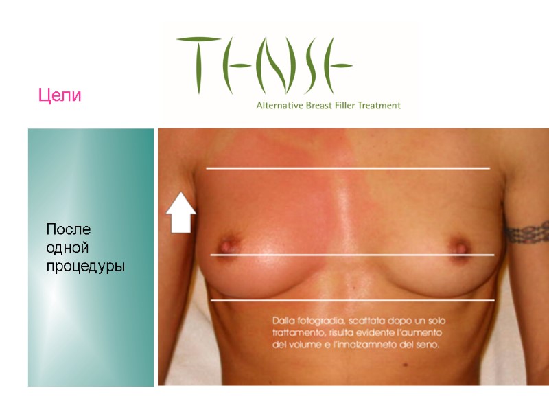 Цели После одной процедуры Цели После одной процедуры